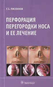 Перфорация перегородки носа и ее лечение.