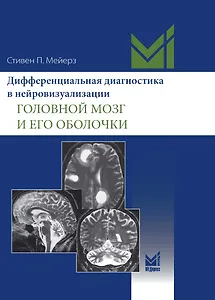 Дифференциальная диагностика в нейровизуализации. Головной мозг и его оболочки