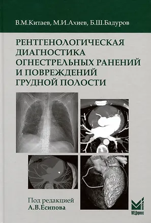 Книга Рентгенологическая диагностика огнестрельных ранений и повреждений грудной полости (Вячеслав Китаев, Магомед Ахиев, Бекир Бадуров)