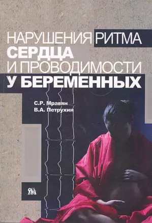 Нарушения ритма сердца и проводимости у беременных / (мягк). Мравян С., Петрухин В. и др. (Миклош) — 2266868 — 1