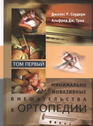 Минимально инвазивные вмешательства в ортопедии: в 2-х томах. Том 1 — 2525258 — 1