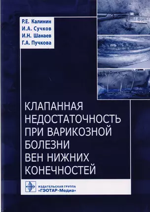 Клапанная недостаточность при варикозной болезни вен нижних конечностей — 2604440 — 1