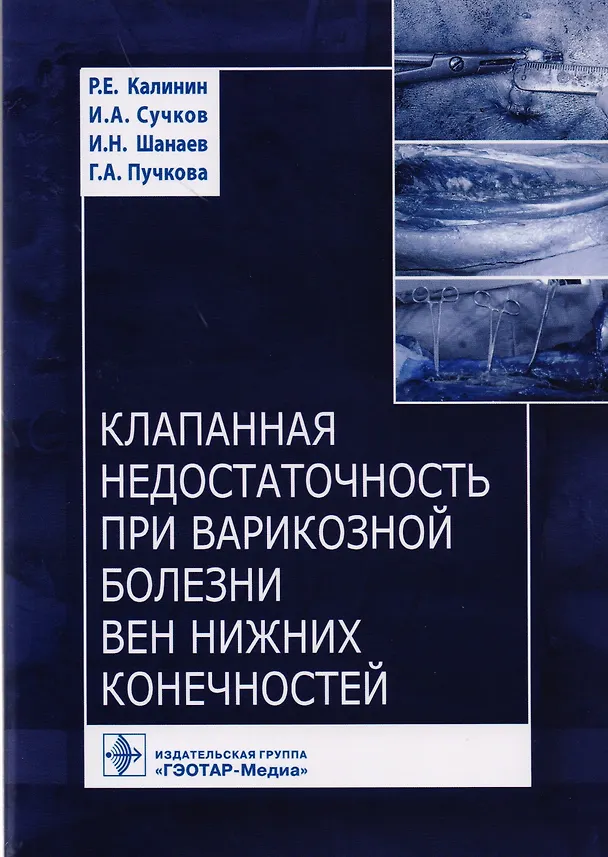 Книга Клапанная недостаточность при варикозной болезни вен нижних конечностей () — 1