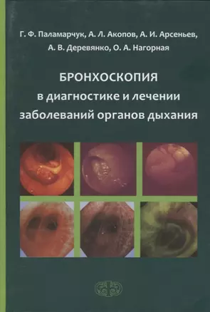 Бронхоскопия в диагностике и лечении заболеваний органов дыхания — 2713446 — 1