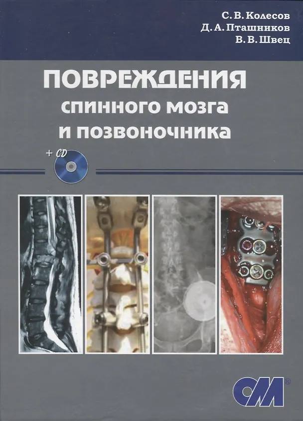 Книга Повреждения спинного мозга и позвоночника (+ CD) (Сергей Колесов) — 1