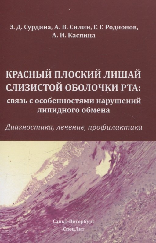 Красный плоский лишай слизистой оболочки рта: связь с особенностями нарушений липидного обмена