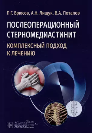 Послеоперационный стерномедиастинит. Комплексный подход к лечению — 3018435 — 1