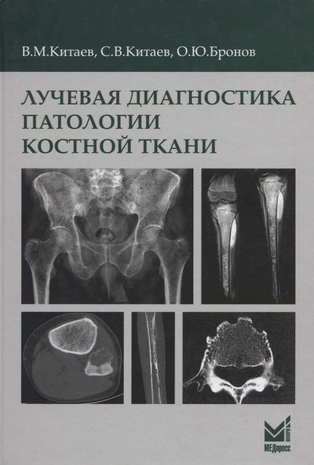 

Лучевая диагностика патологии костной ткани