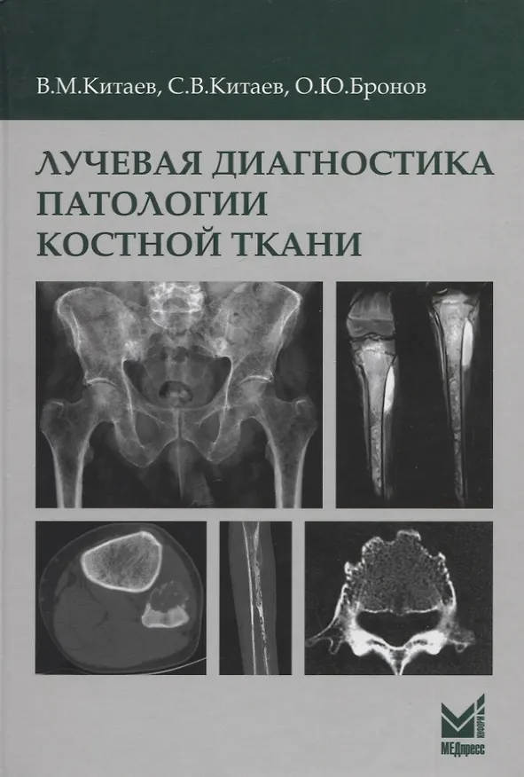 Книга Лучевая диагностика патологии костной ткани (Вячеслав Китаев, Сергей Китаев, Олег Бронов) — 1