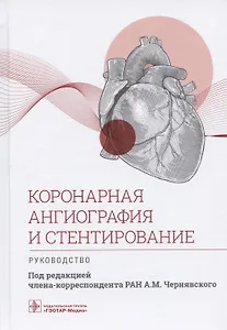 Коронарная ангиография и стентирование. Руководство