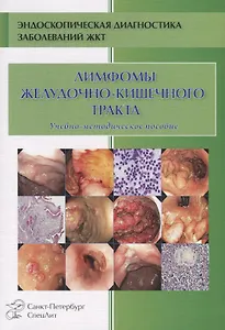 Лимфомы ЖКТ