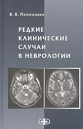 Редкие клинические случаи в неврологии. Руководство для врачей — 2821350 — 1