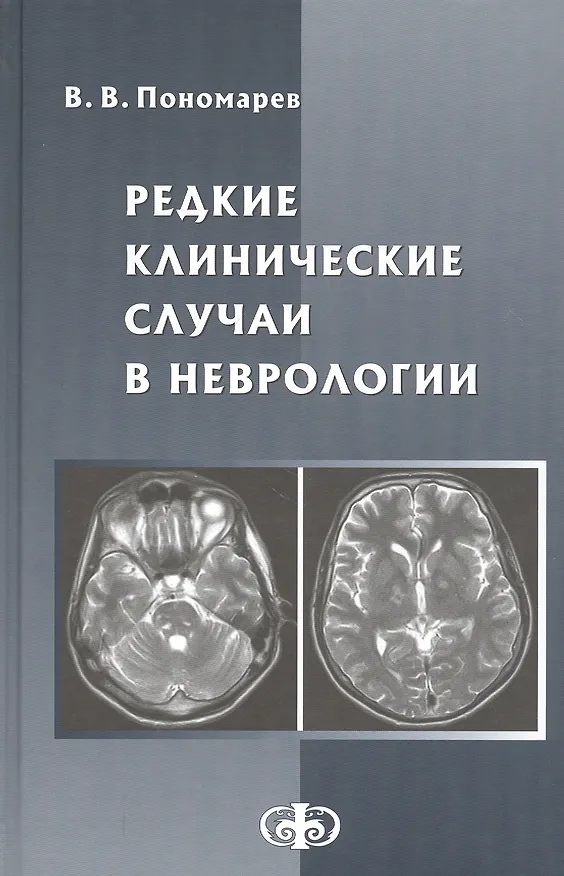 Книга Редкие клинические случаи в неврологии. Руководство для врачей (Владимир Пономарев) — 1