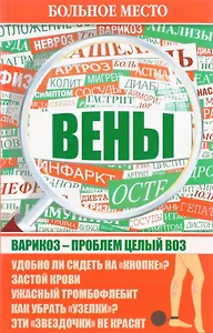 Больное место .Вены