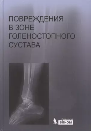 Повреждения в зоне голеностопного сустава : атлас / под ред. академика РАН и РАМН С.П. Миронова. — 2611750 — 1