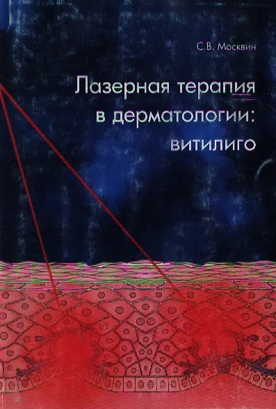 Книга Лазерная терапия в дерматологии Витилиго (мягк). Москвин С. (Юрайт) () — 1