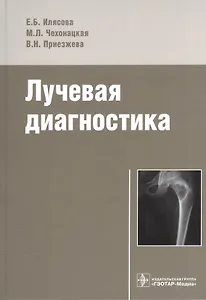 Лучевая диагностика.