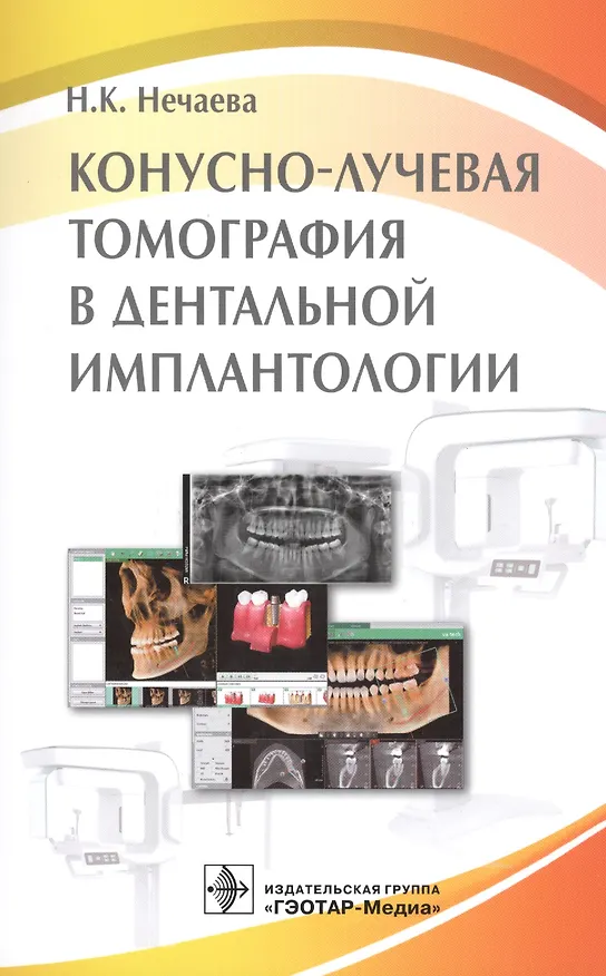Книга Конусно-лучевая томография в дентальной имплантологии (Наталья Нечаева) — 1