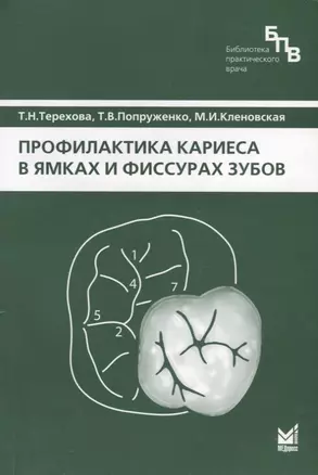 Профилактика кариеса в ямках и фиссурах зубов — 2721641 — 1