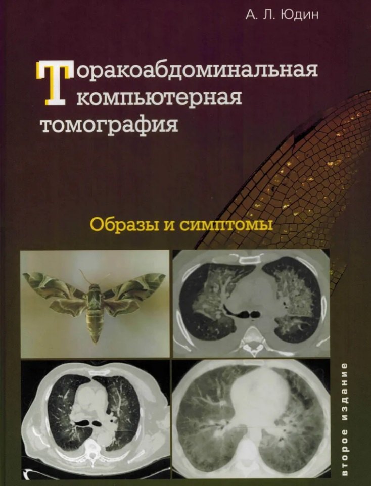 

Торакоабдоминальная компьютерная томография. Образы и симптомы
