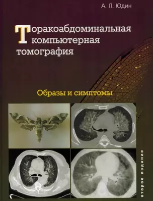 Торакоабдоминальная компьютерная томография. Образы и симптомы — 3043112 — 1