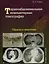 Торакоабдоминальная компьютерная томография. Образы и симптомы — 3043112 — 1