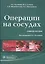 Операции на сосудах : учебное пособие — 2513032 — 1