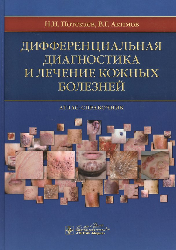 Книга Дифференциальная диагностика и лечение кожных болезней. () — 1