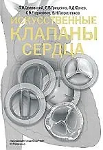 Искусственные клапаны сердца