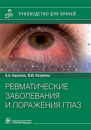 Книга Ревматические заболевания и поражения глаз: руководство для врачей (Алла Годзенко, Ирина Разумова)