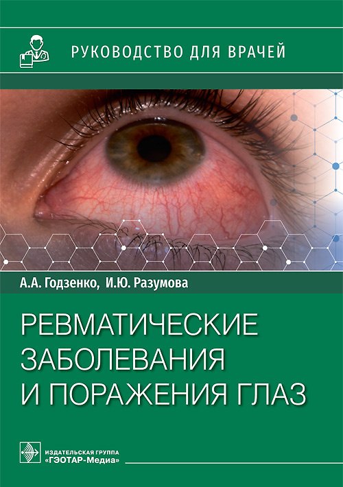 Книга Ревматические заболевания и поражения глаз: руководство для врачей (Алла Годзенко, Ирина Разумова) — 1