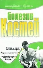 Болезни костей