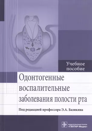 Одонтогенные воспалительные заболевания полости рта. Учебное пособие — 2590455 — 1