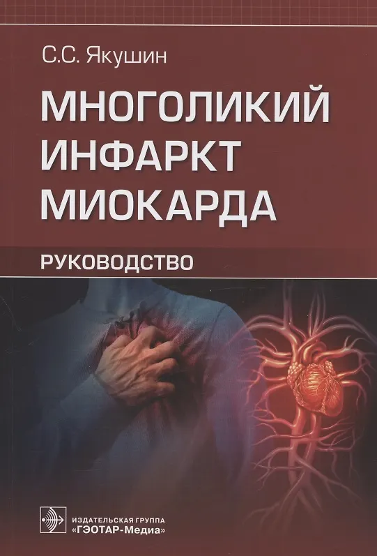 Книга Многоликий инфаркт миокарда: руководство (Сергей Якушин) — 1