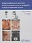 Эндоскопическая хирургия околоносовых пазух и переднего отдела основания черепа — 2643370 — 1