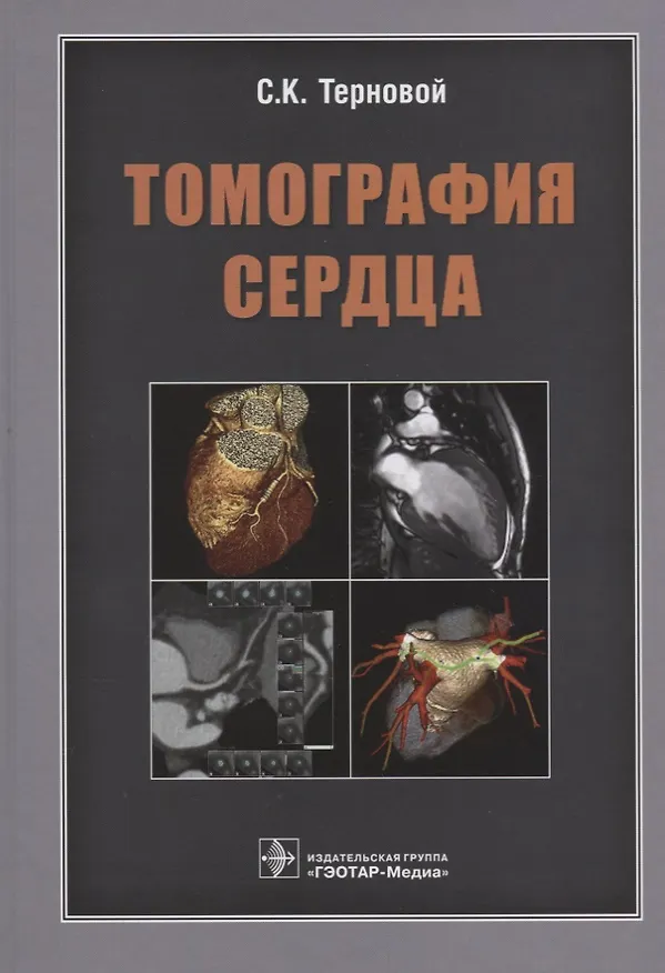 Книга Томография сердца (Сергей Терновой) — 1