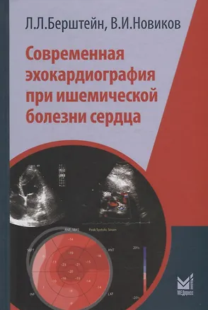 Книга Современная эхокардиография при ишемической болезни сердца (Владимир Новиков, Леонид Берштейн)