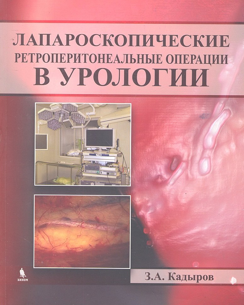 

Лапароскопические ретроперитонеальные операции в урологии