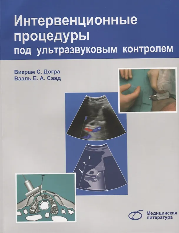 Книга Интервенционные процедуры под ультразвуковым контролем (м) Догра (Викрэм Догра) — 1