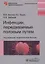 Инфекции, передаваемые половым путем — 2759277 — 1