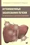 Аутоиммунные заболевания печени:от патогенеза к прогнозу и лечению — 2609602 — 1