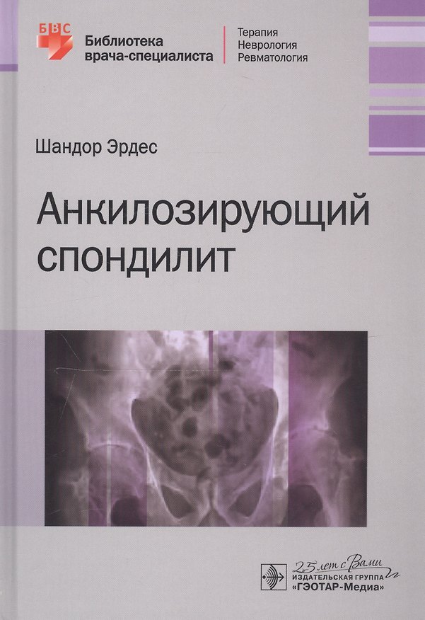Книга Анкилозирующий спондилит () — 1