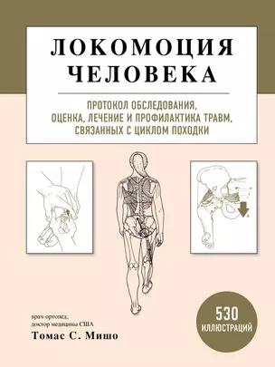 Локомоция человека. Протокол обследования, оценка, лечение и профилактика травм, связанных с циклом походки — 2898679 — 1