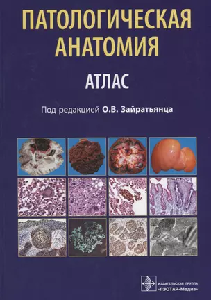 Патологическая анатомия Атлас (Зайратьянц) — 2638344 — 1