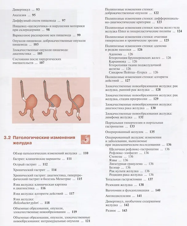 Книга Гастроскопия (Бертольд Блок) — 4