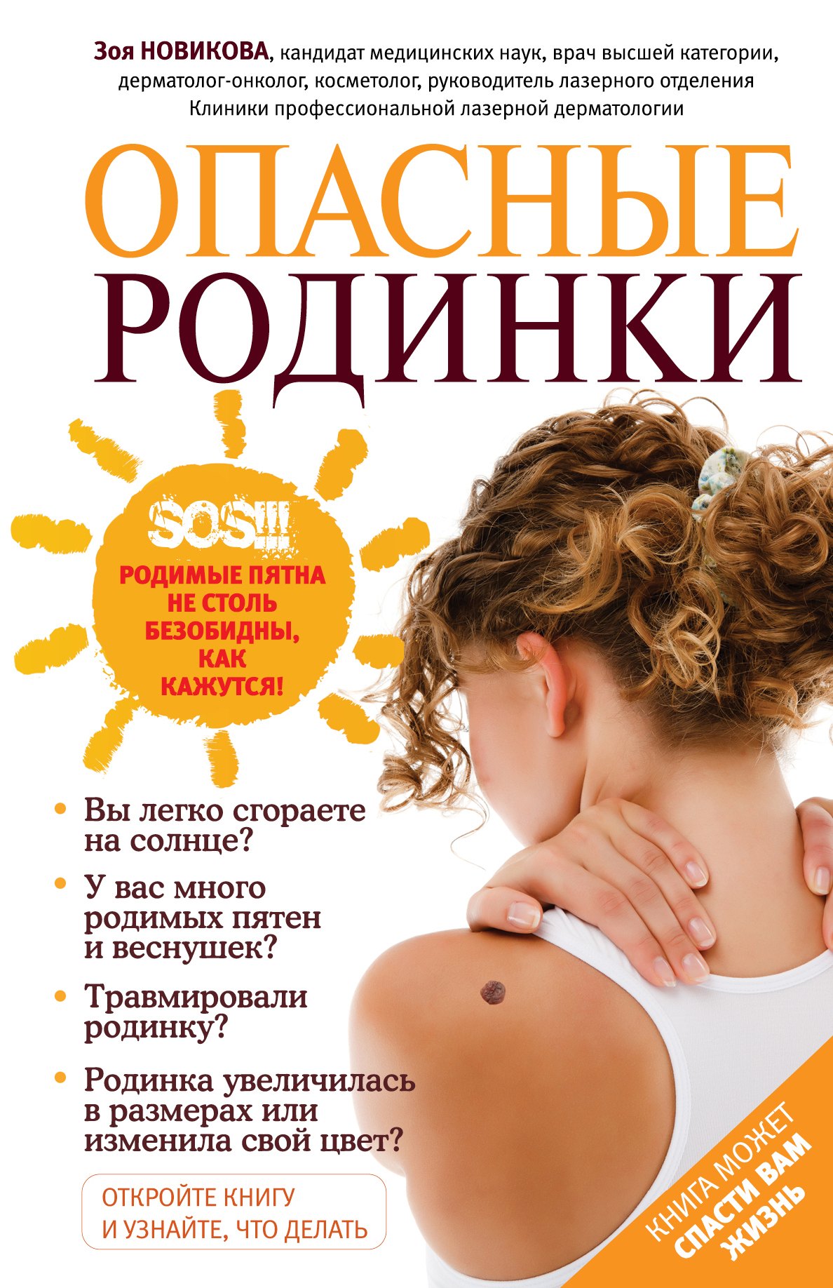 

Опасные родинки
