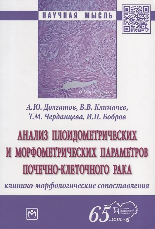 Книга Анализ плоидометрических и морфометрических параметров почечно-клеточного рака. Клинико-морфологического сопоставления. Монография (Андрей Долгатов) — 1