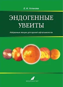 Эндогенные увеиты