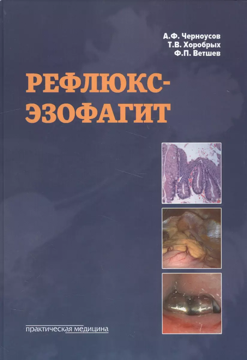 Рефлюкс-эзофагит. (Александр Черноусов) - купить книгу с доставкой в  интернет-магазине «Читай-город». ISBN: 978-5-98811-438-3