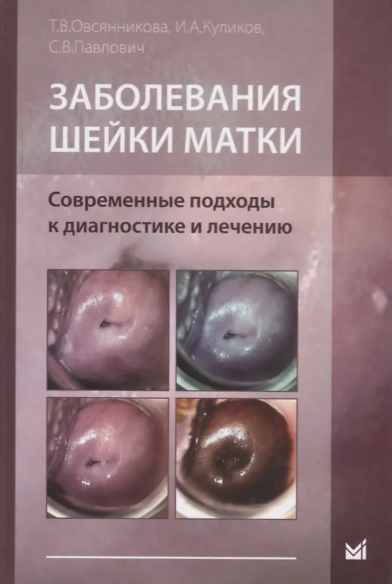 Книга Заболевания шейки матки. Современные подходы к диагностике и (Тамара Овсянникова) — 1